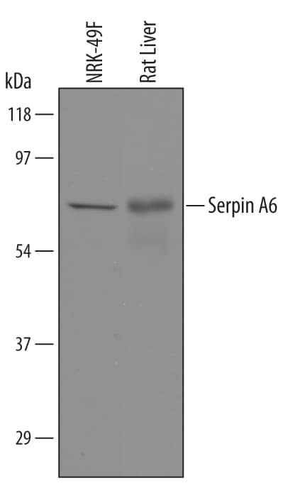 Western Blot Serpin A6/Cortisol Binding Globulin Antibody