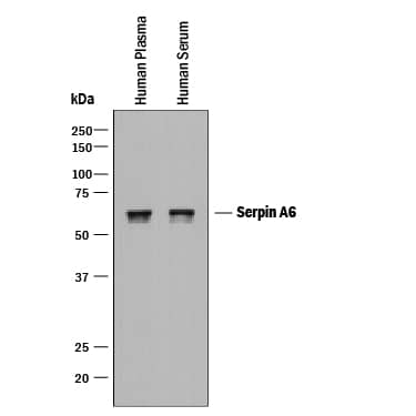 Western Blot Serpin A6/Cortisol Binding Globulin Antibody [Unconjugated]