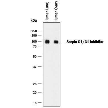     Western  blot shows lysates of human lung tissue and human ovary tissue. PVDF membrane  was probed with 1 µg/mL of Mouse Anti-Human  Serpin G1/C1 Inhibitor Monoclonal Antibody (Catalog #  MAB2488) followed by HRP-conjugated Anti-Mouse IgG Secondary Antibody  (Catalog # HAF018).  A specific band was detected for Serpin G1/C1 Inhibitor at  approximately 100 kDa (as indicated). This experiment was conducted  under reducing conditions and using Immunoblot  Buffer Group 1. 