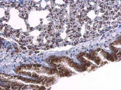 Immunohistochemistry-Paraffin: Serum Response Factor SRF Antibody [NBP1-33063] - Mouse lung SRF dilution: 1:500. Antigen Retrieval: TrilogyTM (EDTA based) buffer, 15min