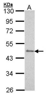 Western Blot: Serum Response Factor SRF Antibody [NBP1-33063] - Sample (30 ug of whole cell lysate) A: Molt-4 10% SDS PAGE, antibody diluted at 1:500.