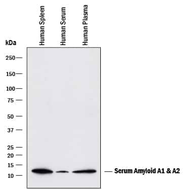 Western Blot Serum Amyloid A1/A2 Antibody (902728) [Unconjugated]