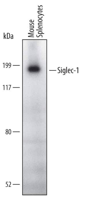 Western blot shows lysates of mouse splenocytes. PVDF Membrane was probed with 1 µg/mL of Mouse Siglec-1/CD169 Monoclonal Antibody (Catalog # MAB5610) followed by HRP-conjugated Anti-Rat IgG Secondary Antibody (HAF005). A specific band was detected for Siglec-1/CD169 at approximately 180 kDa (as indicated). This experiment was conducted under non-reducing conditions and using Immunoblot Buffer Group 1.