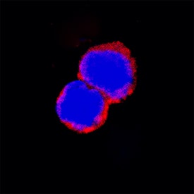 Siglec-2/CD22 was detected in immersion fixed mouse splenocytes using Goat Anti-Mouse Siglec-2/CD22 Antigen Affinity-purified Polyclonal Antibody (Catalog # AF2296) at 15 µg/mL for 3 hours at room temperature. Cells were stained using the NorthernLights™ 557-conjugated Anti-Goat IgG Secondary Antibody (red; Catalog # NL001) and counterstained with DAPI (blue). Specific staining was localized to cell surfaces. View our protocol for Fluorescent ICC Staining of Non-adherent Cells.