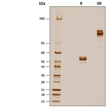 1 μg/lane of Recombinant Mouse Skint2/B7S3 Fc Chimera (Catalog # 10279-B7) was  resolved with SDS-PAGE under reducing (R) and non-reducing (NR)  conditions and visualized by silver staining, showing bands at 48-64 kDa and 95-130 kDa, respectively.