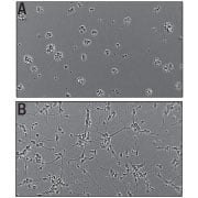 Recombinant Human Slit3 (Catalog #9255-SL) Induces Cortical Neurite Outgrowth.  A) Untreated  E16-18 embryonic rat cortical neurons.  B) Neurite outgrowth in E16-18 embryonic rat cortical  neurons treated with 5 μg/mL of Recombinant Human Slit3.