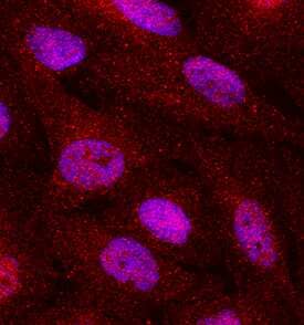 Smad2/3 phosphorylated at S465/S467 and S423/S425 was detected in immersion fixed Mv1Lu mink lung epithelial cell line treated with 10 ng/mL of Recombinant Human TGF-beta 2 (Catalog # 302-B2) using Rabbit Anti-Human Phospho-Smad2 (S465/S467)/ Smad3 (S423/S425) Polyclonal Antibody (Catalog # AB3226) at 1:50-1:100 dilution for 3 hours at room temperature. Cells were stained using the NorthernLights™ 557-conjugated Anti-Rabbit IgG Secondary Antibody (red; Catalog # NL004) and counterstained with DAPI (blue). Specific staining was localized to nuclei. View our protocol for Fluorescent ICC Staining of Cells on Coverslips.