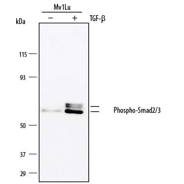 Western blot shows lysates of Mv1Lu mink lung epithelial cell line untreated (-) or treated (+) with 10 ng/mL Recombinant Human TGF-beta 2 (Catalog # 302-B2) for 24 hours. PVDF membrane was probed with 1:500 dilution of Rabbit Anti-Human Phospho-Smad2 (S465/S467)/ Smad3 (S423/S425)Polyclonal Antibody (Catalog # AB3226), followed by HRP-conjugated Anti-Rabbit IgG Secondary Antibody (Catalog # HAF008). Specific bands were detected for Phospho-Smad2 (S465/S467)/ Smad3 (S423/S425) at approximately 60 kDa (as indicated). This experiment was conducted under reducing conditions and using Immunoblot Buffer Group 1.