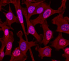     Smad3  was detected in immersion fixed MDA‑MB‑231 human breast  cancer cell line using Rat Anti-Human Smad3 Monoclonal Antibody (Catalog #  MAB4038) at 10 µg/mL for 3 hours at room temperature.  Cells were stained using the NorthernLights™ 557-conjugated  Anti-Rat IgG Secondary Antibody (red; Catalog # NL013)  and counterstained with DAPI (blue). Specific staining was localized to  cytoplasm and nuclei. View our protocol for Fluorescent  ICC Staining of Cells on Coverslips. 