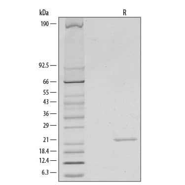 1 μg/lane of Recombinant Mouse Sonic Hedgehog/Shh, N-Terminus was resolved with SDS-PAGE under reducing (R) conditions and visualized by silver staining, showing a single band at 23 kDa.