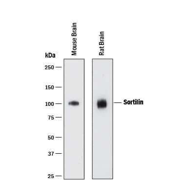 Western blot shows lysates of mouse brain tissue and rat brain tissue. PVDF membrane was probed with 1 µg/mL of Mouse Anti-Human/Mouse/Rat Sortilin Monoclonal Antibody (Catalog # MAB3154) followed by HRP-conjugated Anti-Mouse IgG Secondary Antibody (Catalog # HAF018). A specific band was detected for Sortilin at approximately 100 kDa (as indicated). This experiment was conducted under reducing conditions and using Immunoblot Buffer Group 1.