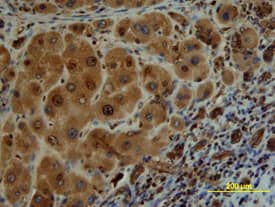 Src was detected in immersion fixed paraffin-embedded sections of human liver array using Human/Mouse/Rat Src Antigen Affinity-purified Polyclonal Antibody (Catalog # AF3389) at 10 µg/mL overnight at 4 °C. Tissue was stained using the Anti-Goat HRP-DAB Cell & Tissue Staining Kit (brown; Catalog # CTS008) and counterstained with hematoxylin (blue). View our protocol for Chromogenic IHC Staining of Paraffin-embedded Tissue Sections.