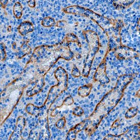 Stabilin-2 was detected in immersion fixed paraffin-embedded sections of human spleen using Mouse Anti-Human Stabilin-2 Monoclonal Antibody (Catalog # MAB3645) at 15 µg/mL overnight at 4 °C. Tissue was stained using the Anti-Mouse HRP-DAB Cell & Tissue Staining Kit (brown; Catalog # CTS002) and counterstained with hematoxylin (blue). Specific staining was localized to epithelial cells. View our protocol for Chromogenic IHC Staining of Paraffin-embedded Tissue Sections.