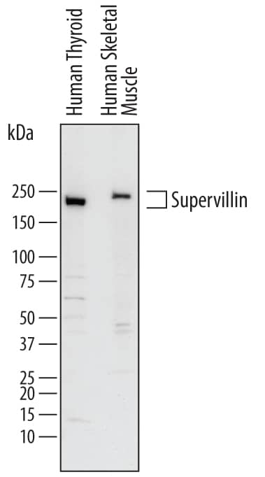 Western blot shows lysates of human thyroid tissue and human skeletal muscle tissue. PVDF membrane was probed with 1 µg/mL of Goat Anti-Human Supervillin Antigen Affinity-purified Polyclonal Antibody (Catalog # AF7338) followed by HRP-conjugated Anti-Goat IgG Secondary Antibody (Catalog # HAF017). Specific bands were detected for Supervillin at approximately 240-250 kDa (as indicated). This experiment was conducted under reducing conditions and using Immunoblot Buffer Group 1.