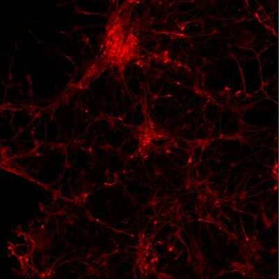 Immunocytochemistry/Immunofluorescence: alpha-Synuclein Antibody [NBP2-25146] - Human iPS derived neurons, fixed in 4% formaldehyde solution. NBP2-25146 diluted 1:1500, followed by staining with Alexa anti chicken-594 (1:1000) secondary antibody. All antibodies were diluted in PBS/BSA 3% (w/v) ) Triton X-100  0,3 % (v/v). Images taken by an Arrayscan (Cellomics). Image from verified customer review. 