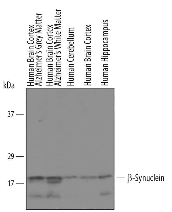 Western Blot beta-Synuclein Antibody [Unconjugated]