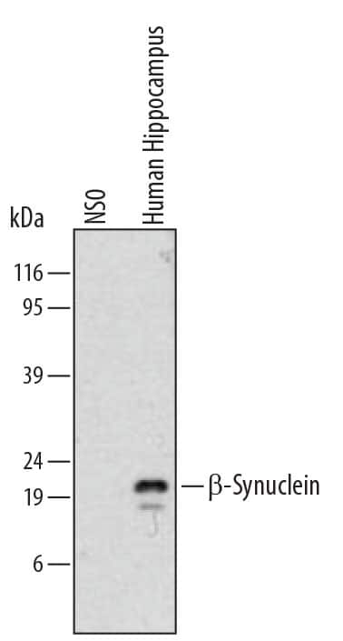 Western Blot beta-Synuclein Antibody (516505) [Unconjugated]