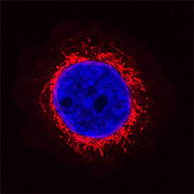 gamma-Synuclein was detected in immersion fixed MBA-MB-468 human breast cancer cell line using Recombinant Mouse Anti-Human gamma-Synuclein Monoclonal Antibody (Catalog # MAB5745R) at 1.7 µg/mL for 3 hours at room temperature. Cells were stained using the NorthernLights™ 557-conjugated Anti-Mouse IgG Secondary Antibody (red; Catalog # NL007) and counterstained with DAPI (blue). Specific staining was localized to cytoplasm. View our protocol for Fluorescent ICC Staining of Non-adherent Cells.