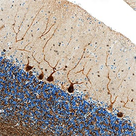 gamma-Synuclein was detected in immersion fixed paraffin-embedded sections of human brain (cerebellum) using Recombinant Mouse Anti-Human gamma-Synuclein Monoclonal Antibody (Catalog # MAB5745R) at 1 µg/mL overnight at 4 °C. Tissue was stained using the Anti-Mouse HRP-DAB Cell & Tissue Staining Kit (brown; Catalog # CTS002) and counterstained with hematoxylin (blue). Specific staining was localized to Purkinje neurons. View our protocol for Chromogenic IHC Staining of Paraffin-embedded Tissue Sections.
