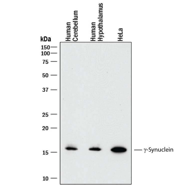 Western blot shows lysates of human brain (cerebellum) tissue, human brain (hypothalamus) tissue, and HeLa human cervical epithelial carcinoma cell line. PVDF membrane was probed with 0.5 µg/mL of Recombinant Mouse Anti-Human gamma-Synuclein Monoclonal Antibody (Catalog # MAB5745R) followed by HRP-conjugated Anti-Mouse IgG Secondary Antibody (Catalog # HAF018). A specific band was detected for gamma-Synuclein at approximately 16 kDa (as indicated). This experiment was conducted under reducing conditions and using Immunoblot Buffer Group 1.