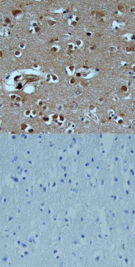 TAFA1/FAM19A1 was detected in immersion fixed paraffin-embedded sections of human brain (cortex) using Goat Anti-Human TAFA1/FAM19A1 Antigen Affinity-purified Polyclonal Antibody (Catalog # AF5154) at 15 µg/mL overnight at 4 °C. Tissue was stained using the Anti-Goat HRP-DAB Cell & Tissue Staining Kit (brown; Catalog # CTS008) and counterstained with hematoxylin (blue). Lower panel shows a lack of labeling when primary antibodies are omitted and tissue is stained only with secondary antibody followed by incubation with detection reagents. View our protocol for Chromogenic IHC Staining of Paraffin-embedded Tissue Sections.