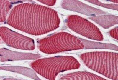 Immunohistochemistry-Paraffin: TBC1D4 Antibody [NB100-57094] - (3.8ug/ml) staining of Human Skeletal Muscle. Steamed antigen retrieval with citrate buffer pH 6, AP-staining.