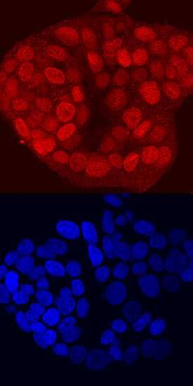 TBX2 was detected in immersion fixed MCF-7 human breast cancer cell line using Rat Anti-Human TBX2 Monoclonal Antibody (Catalog # MAB50401) at 10 µg/mL for 3 hours at room temperature. Cells were stained using the NorthernLights™ 557-conjugated Anti-Rat IgG Secondary Antibody (red, upper panel; Catalog # NL013) and counterstained with DAPI (blue, lower panel). Specific staining was localized to nuclei. View our protocol for Fluorescent ICC Staining of Cells on Coverslips.