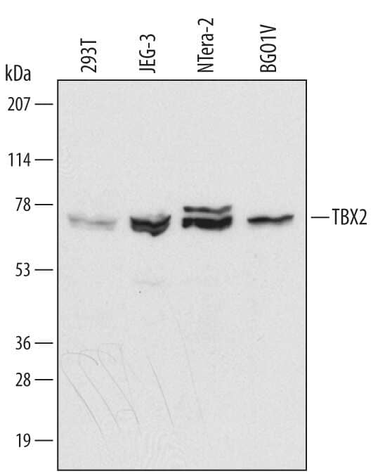 Western blot shows lysates of HEK293T human embryonic kidney cell line, JEG-3 human epithelial choriocarcinoma cell line, NTera-2 human testicular embryonic carcinoma cell line, and BG0IV human embryonic stem cells. PVDF membrane was probed with 0.1 µg/mL of Human TBX2 Monoclonal Antibody (Catalog # MAB5040) followed by HRP-conjugated Anti-Rat IgG Secondary Antibody (Catalog # HAF005). A specific band was detected for TBX2 at approximately 75 kDa (as indicated). This experiment was conducted under reducing conditions and using Immunoblot Buffer Group 1.