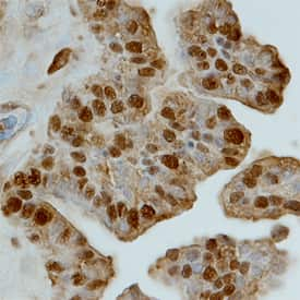 TCF7L1 was detected in immersion fixed paraffin-embedded sections of human brain (hippocampus) using Human TCF7L1 Monoclonal Antibody (Catalog # MAB61161) at 15 µg/mL overnight at 4 °C. Before incubation with the primary antibody, tissue was subjected to heat-induced epitope retrieval using Antigen Retrieval Reagent-Basic (Catalog # CTS013). Tissue was stained using the Anti-Mouse HRP-DAB Cell & Tissue Staining Kit (brown; Catalog # CTS002) and counterstained with hematoxylin (blue). View our protocol for Chromogenic IHC Staining of Paraffin-embedded Tissue Sections.