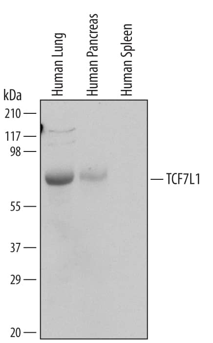 Western blot shows lysates of human lung tissue, human pancreas tissue, and human spleen tissue. PVDF Membrane was probed with 1 µg/mL of Mouse Anti-Human TCF7L1/TCF3 Monoclonal Antibody (Catalog # MAB6116) followed by HRP-conjugated Anti-Mouse IgG Secondary Antibody (Catalog # HAF007). A specific band was detected for TCF7L1 at approximately 75 kDa (as indicated). This experiment was conducted under reducing conditions and using Immunoblot Buffer Group 1.