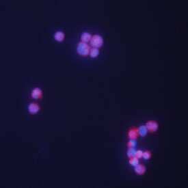 TCL1A was detected in immersion fixed Daudi human Burkitt's lymphoma cell line using 10 µg/mL Goat Anti-Human TCL1A Antigen Affinity-purified Polyclonal Antibody (Catalog # AF4847) for 3 hours at room temperature. Cells were stained with the NorthernLights™ 557-conjugated Anti-Goat IgG Secondary Antibody (red; Catalog # NL001) and counterstained with DAPI (blue). View our protocol for Fluorescent ICC Staining of Cells on Coverslips.