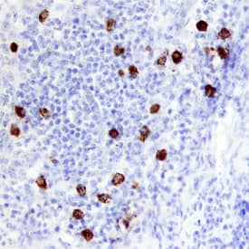 TCL1B was detected in immersion fixed paraffin-embedded sections of human lymphoma using Goat Anti-Human TCL1B Antigen Affinity-purified Polyclonal Antibody (Catalog # AF6794) at 3 µg/mL overnight at 4 °C. Before incubation with the primary antibody, tissue was subjected to heat-induced epitope retrieval using Antigen Retrieval Reagent-Basic (Catalog # &lt;a class=