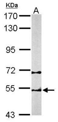 TCP1-beta Antibody (NBP1-33418): Novus Biologicals