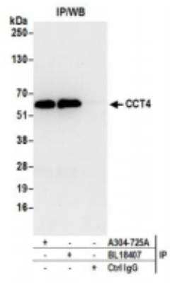 Tcp1-delta Antibody (nbp2-41360): Novus Biologicals