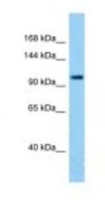 Western Blot: TDRD7 Antibody [NBP1-98585] - Rat Small Intestine Lysate 1.0ug/ml