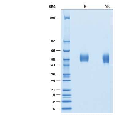 2 μg/lane of Recombinant Human TEM5/GPR124 His-tag (Catalog # 10206-TE) was  resolved with SDS-PAGE under reducing (R) and non-reducing (NR)  conditions and visualized by Coomassie® Blue staining, showing bands at 53-60 kDa.