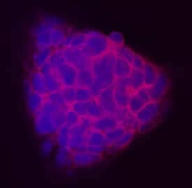 TEX19.1 was detected in immersion fixed D3 mouse embryonic stem cell line using Mouse TEX19.1 Monoclonal Antibody (Catalog # MAB6645) at 10 µg/mL for 3 hours at room temperature. Cells were stained using the NorthernLights™ 557-conjugated Anti-Rat IgG Secondary Antibody (red; Catalog # NL013) and counterstained with DAPI (blue). Specific staining was localized to cytoplasm. View our protocol for Fluorescent ICC Staining of Cells on Coverslips.