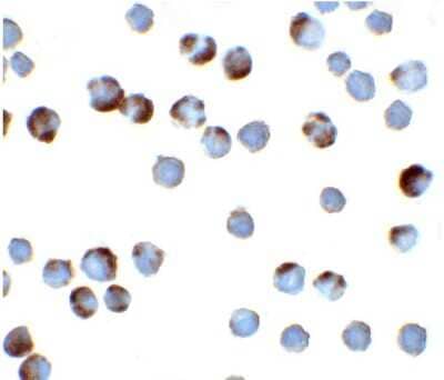 Immunocytochemistry: TFF3 Antibody [NBP1-76514] - TFF3 in HeLa cells with TFF3 antibody at 2 ug/ml.