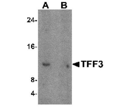 Western Blot: TFF3 Antibody [NBP1-76514] - Analysis of TFF3 in human colon tissue lysate with TFF3 antibody at 1 ug/mL in (A) the absence and (B) the presence of blocking peptide