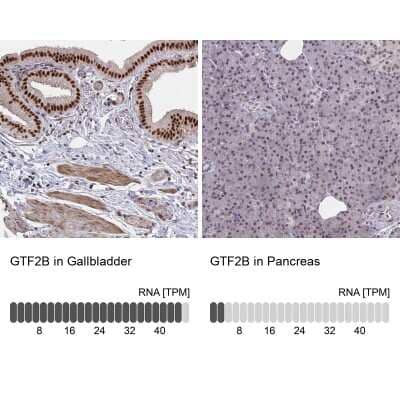 Immunohistochemistry-Paraffin: TFIIB Antibody [NBP2-34143] - Staining in human gallbladder and pancreas tissues using anti-GTF2B antibody. Corresponding GTF2B RNA-seq data are presented for the same tissues.