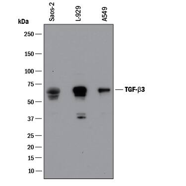     Western  blot shows lysates of Saos‑2 human osteosarcoma cell line,  L‑929 mouse fibroblast cell line, and A549 human lung carcinoma  cell line. PVDF membrane was probed with 1 µg/mL of Goat  Anti-TGF‑ beta 3 Antigen Affinity-purified Polyclonal Antibody (Catalog  # AF-243-NA) followed by HRP-conjugated Anti-Goat IgG Secondary Antibody  (Catalog # HAF017).  A specific band was detected for TGF‑ beta 3 at approximately  67 kDa (as indicated). This experiment was conducted under reducing  conditions and using Immunoblot  Buffer Group 1. 