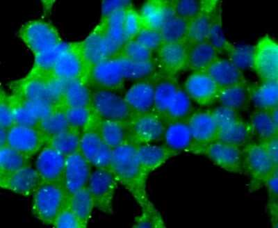 Transglutaminase 3 Tgm3 Antibody Nbp1 86950 Novus Biologicals