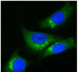 Immunocytochemistry/Immunofluorescence: TGN38 Antibody [NBP1-03495] - Human Melanoma cell line C 32