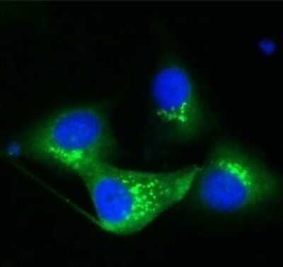 Immunocytochemistry/Immunofluorescence: TGN38 Antibody [NBP1-03495] - Human Melanoma cell line C 32 was cultured overnight on round cover slides placed in a 24 well tissue culture plate. Culture media removed and washed twice with PBS before fixing with 2% formalin for 10 minutes. Cells were then washed three times with PBS and incubated with Tris 0.01M containing Triton X 0.005% for 15 minutes. Cells were washed and incubated with 100 ul of Rabbit antibody to TGN diluted 1:100 in the blocking buffer for 30 minutes. Welles were then washed 7 times with PBS and incubated with 100 ul of anti Rb-FITC conjugate diluted 1:100 in the blocking buffer for further 30 minutes. Cells were washed as before and nuclear counter stained with Hoechst and mounted on to slides.