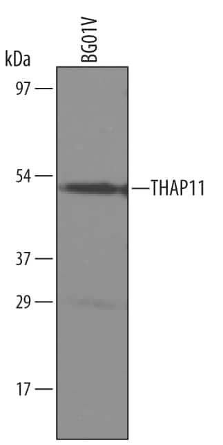 Western Blot THAP11 Antibody