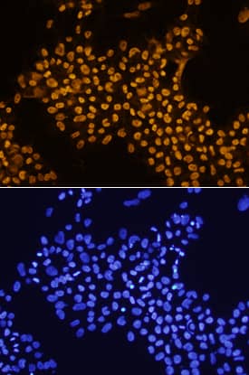 THAP11 was detected in immersion fixed undifferentiated BG01V human embryonic stem cells using Mouse Anti-Human/Mouse THAP11 Monoclonal Antibody (Catalog # MAB5727) at 10 µg/mL for 3 hours at room temperature. Cells were stained using the NorthernLights™ 557-conjugated Anti-Mouse IgG Secondary Antibody (yellow; Catalog # NL007) and counterstained with DAPI (blue). Specific staining was localized to nuclei. View our protocol for Fluorescent ICC Staining of Cells on Coverslips.