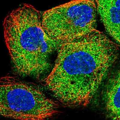 THUMPD1 Antibody (NBP1-82194): Novus Biologicals