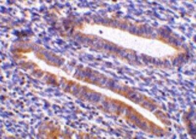 Immunohistochemistry-Paraffin: TIM-1/KIM-1/HAVCR Antibody [NBP1-76701] - Analysis of  human uterus tissue using anti-TIM-1 antibody (3809) at 10 ug/ml.Tissue was fixed with formaldehyde and blocked with 10% serum for 1 h at RT; antigen retrieval was by heat mediation with a citrate buffer (pH6). Samples were incubated with primary antibody overnight at 4  C. A goat anti-rabbit IgG H&amp;L (HRP)at 1/250 was used as secondary. Counter stained with Hematoxylin.