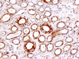 TIM-1/KIM-1/HAVCR was detected in immersion fixed paraffin-embedded sections of human kidney using 25 µg/mL Mouse Anti-Human TIM-1/ KIM-1/HAVCR Monoclonal Antibody (Catalog # MAB1750) overnight at 4 °C. Tissue was stained with the Anti-Mouse HRP-DAB Cell & Tissue Staining Kit (brown; CTS002) and counterstained with hematoxylin (blue). View our protocol for Chromogenic IHC Staining of Paraffin-embedded Tissue Sections.