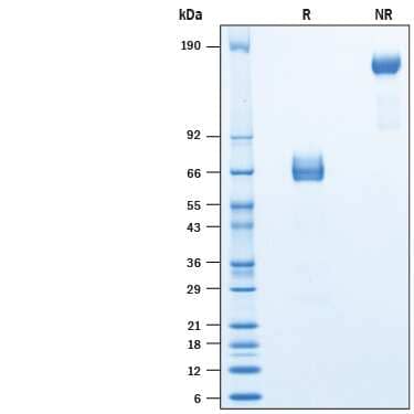 2 μg/lane of Recombinant Rat TIM-3 Fc Chimera Protein (Catalog # 10489-TM) was resolved withSDS-PAGE under reducing (R) and non-reducing (NR) conditions and visualized byCoomassie® Blue staining, showing bands at kDa.